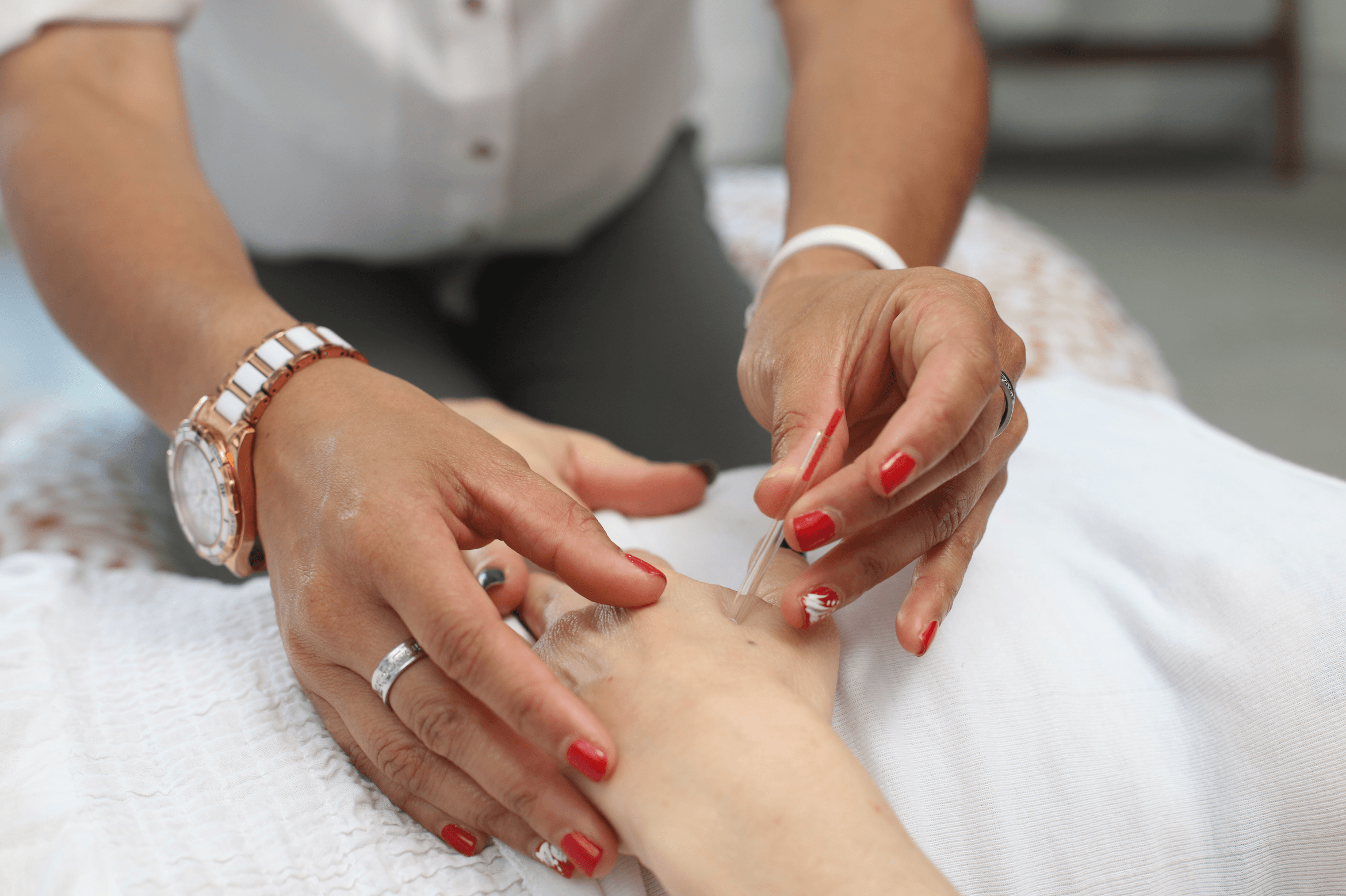 Practitioner giving acupuncture to a patient