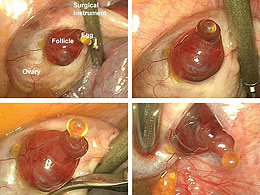 Captured on film - the moment of ovulation