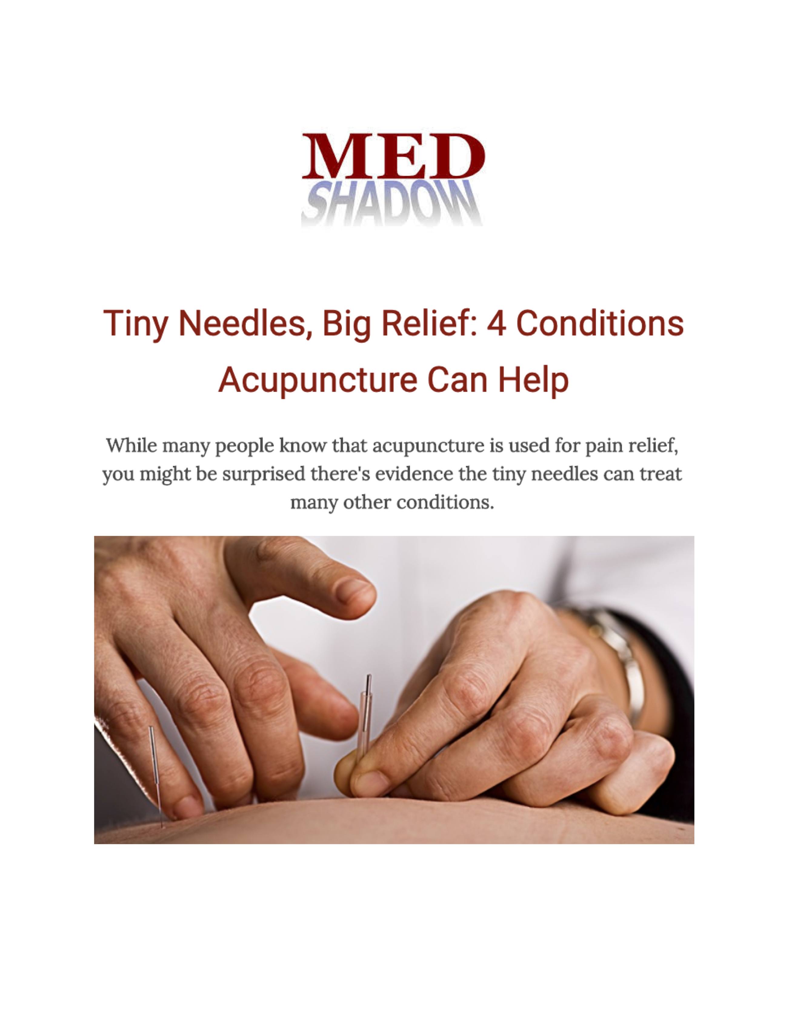 MedShadow: Tiny Needles, Big Relief: 4 Conditions Acupuncture Can Help