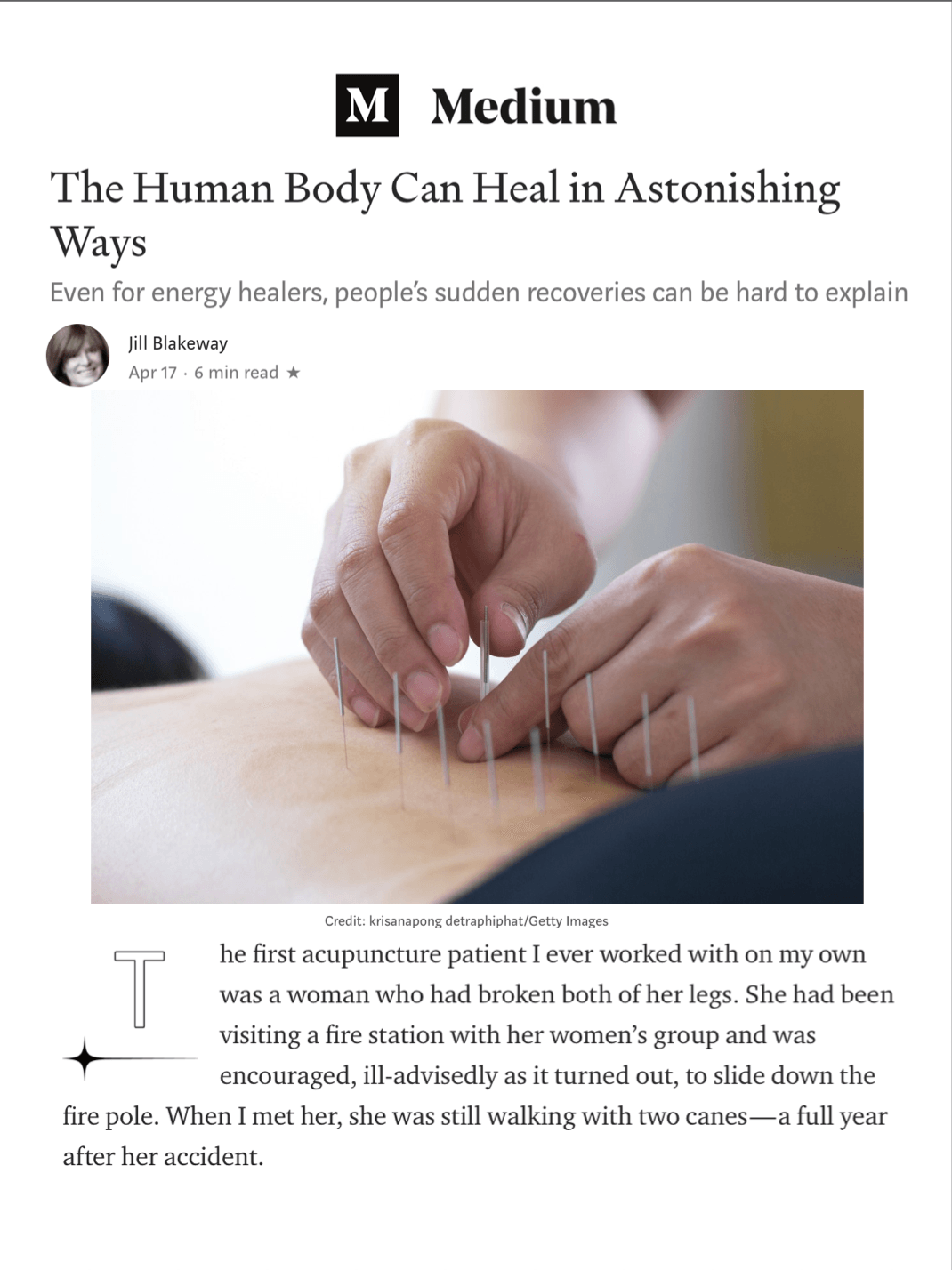 Medium: The Human Body Can Heal in Astonishing Ways