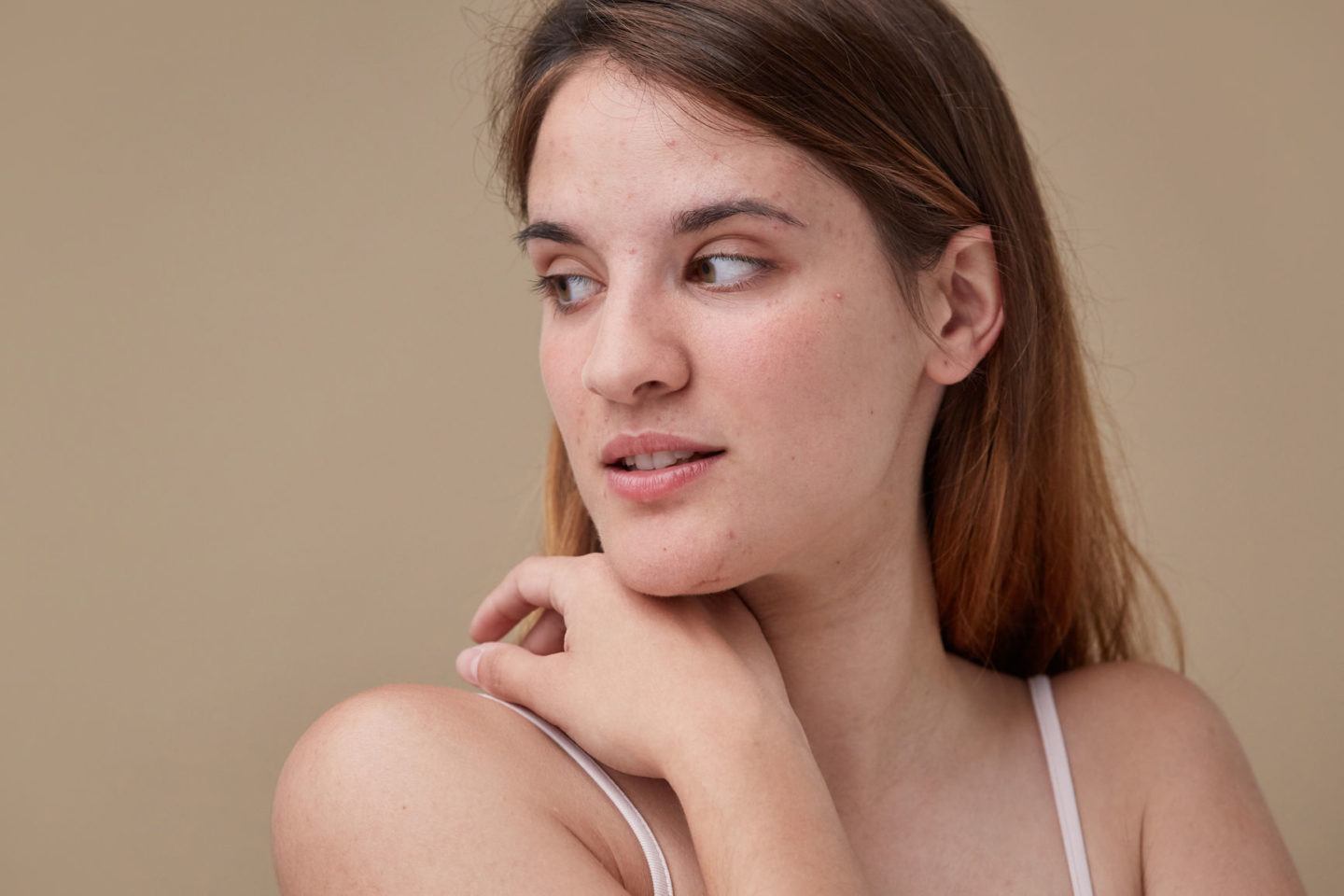 Woman with Sensitive Skin