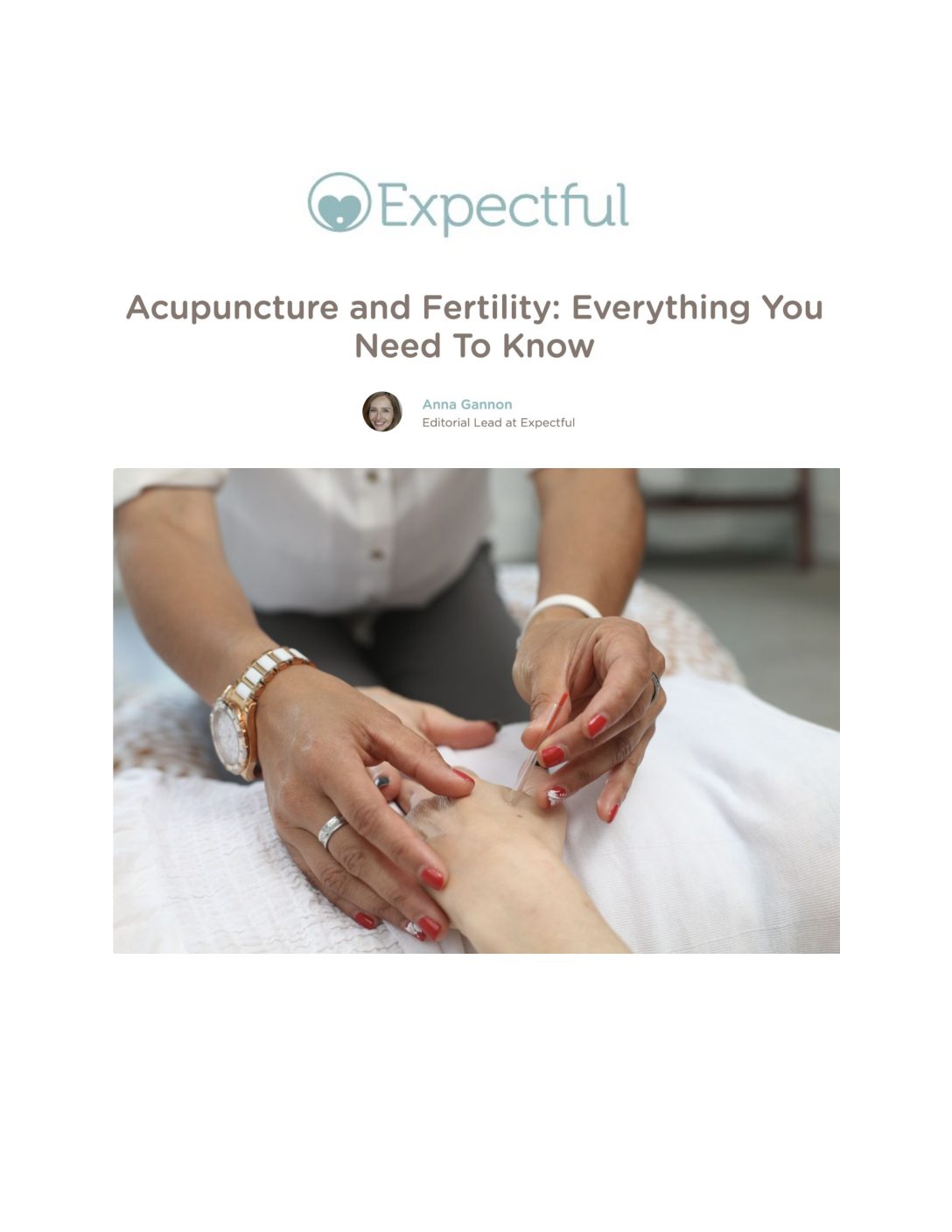Expectful: Acupuncture and Fertility: Everything You Need To Know