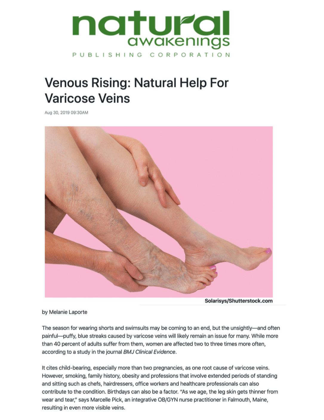 Natural Awakenings: Natural Help For Varicose Veins